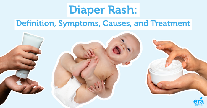 baby rashes