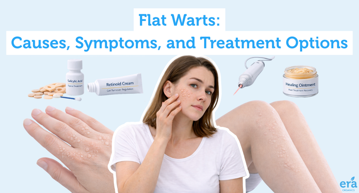 Flat Warts: Causes, Symptoms, and Treatment Options
