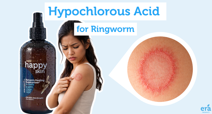 Hypochlorous Acid for Ringworm