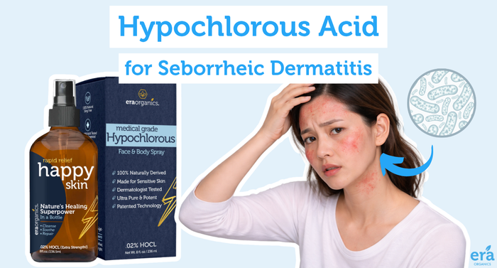Hypochlorous Acid for Seborrheic Dermatitis