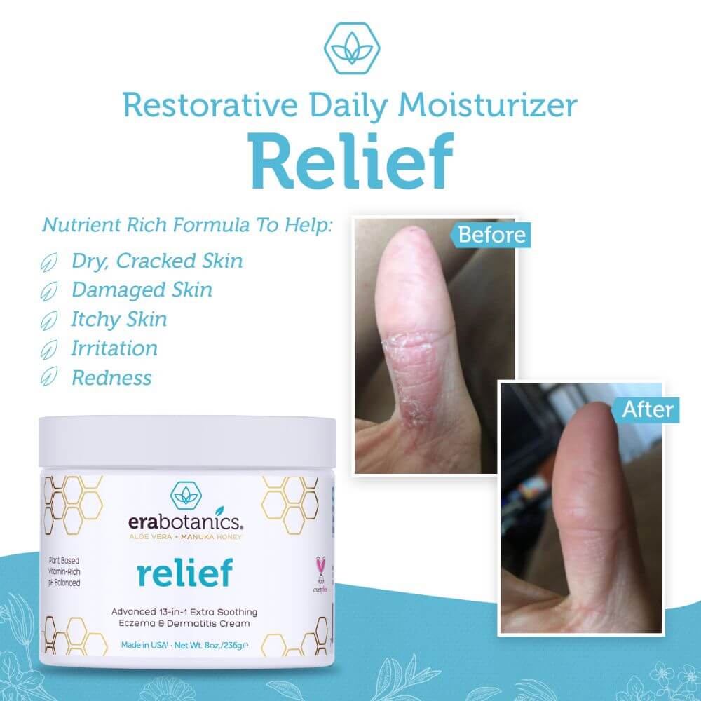 Dermatitis cream